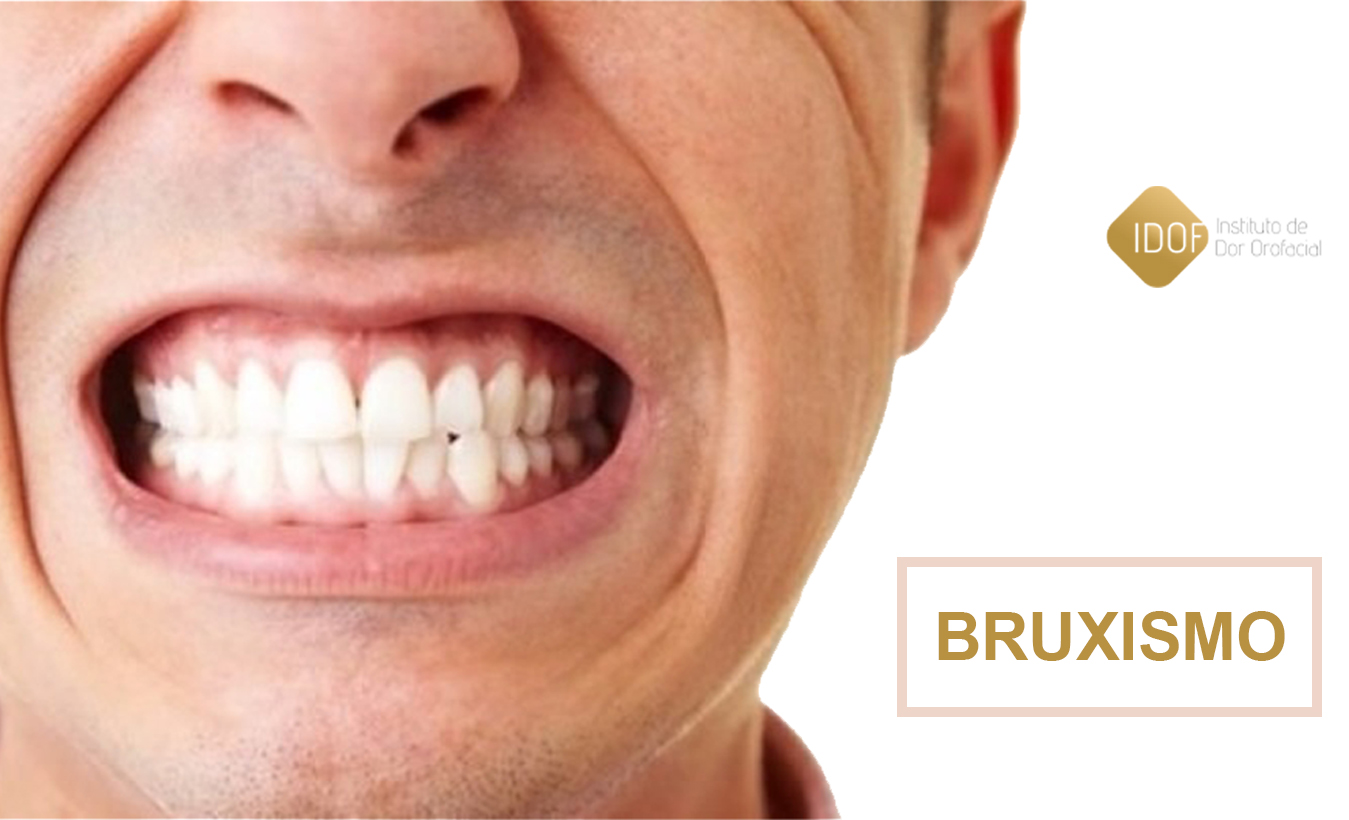 Banner 2 - Bruxismo